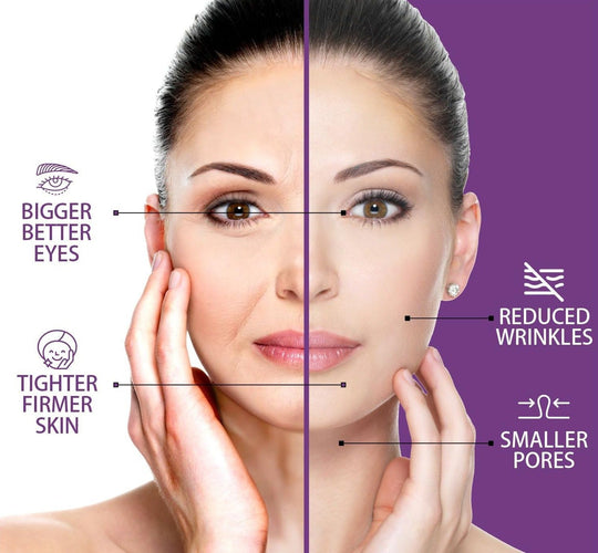 RadiantLift™ | Anti-Aging Device - Visible Rejuvenation